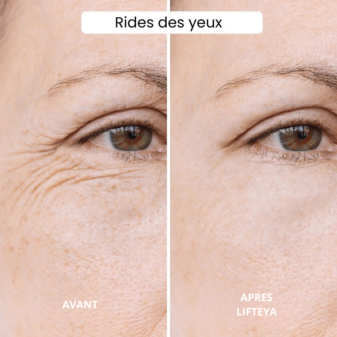 LIFTEYA® - Effet Lifting Sans Chirurgie