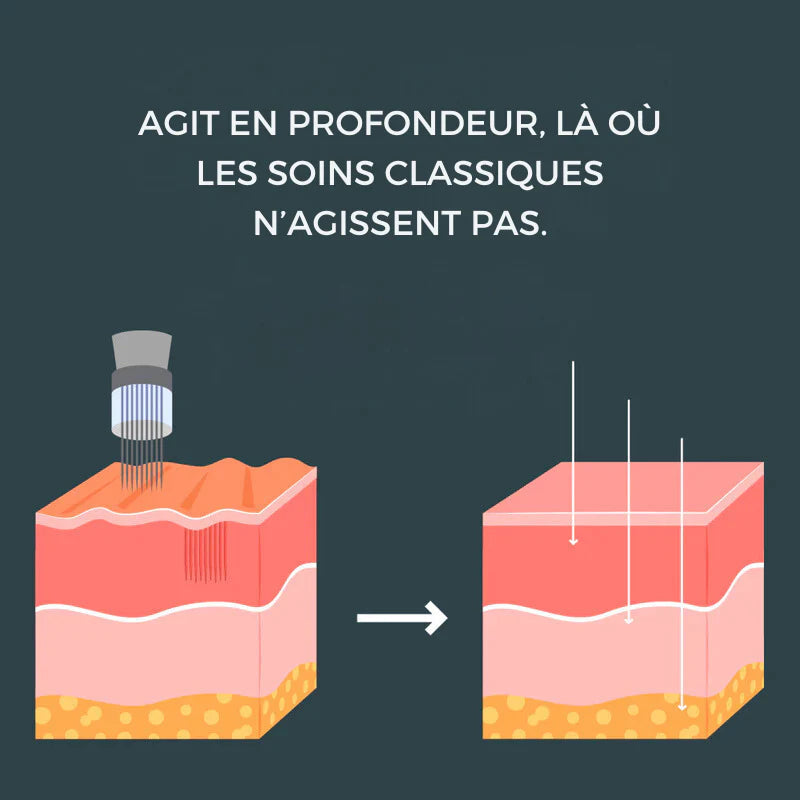 LIFTEYA® - Effet Lifting Sans Chirurgie