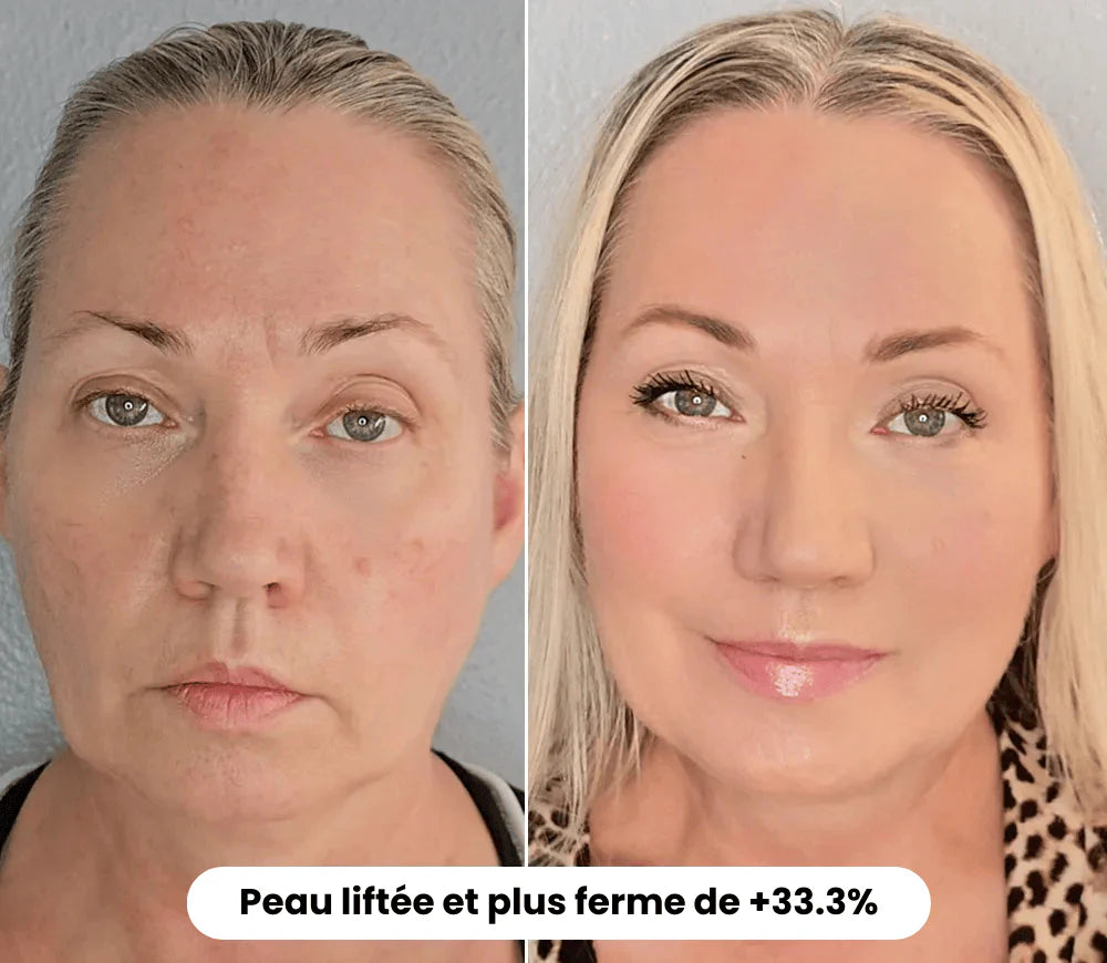 LIFTEYA® - Effet Lifting Sans Chirurgie